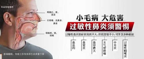 过敏性鼻炎的危害 过敏性鼻炎的危害